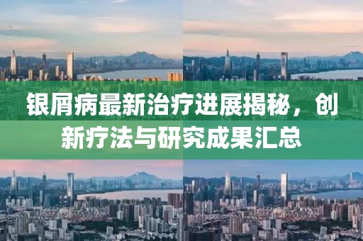 銀屑病最新治療進展揭秘，創(chuàng)新療法與研究成果匯總